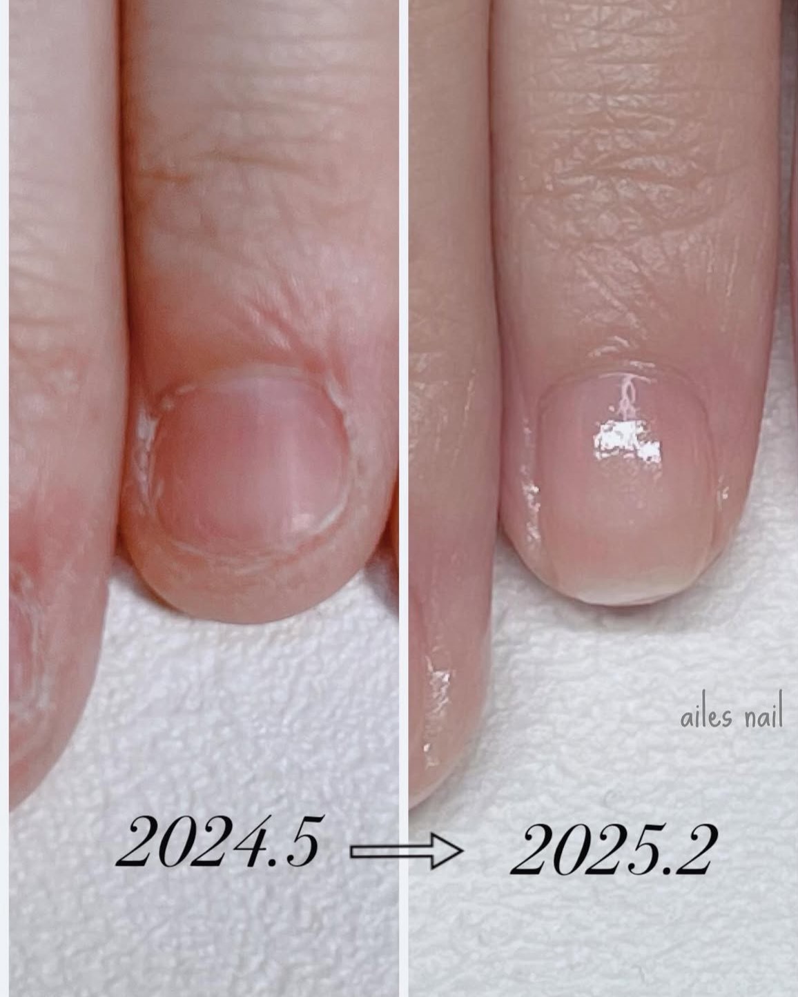beforeafter