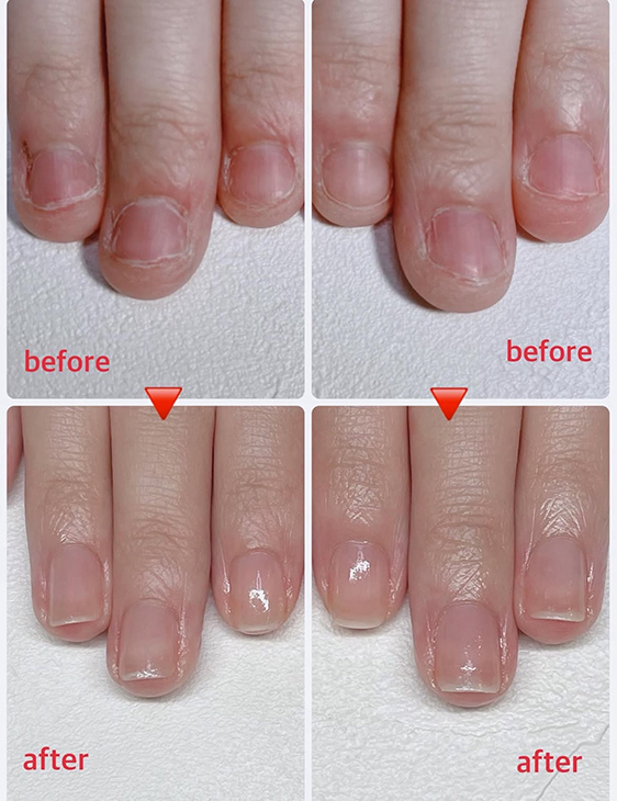 beforeafter1